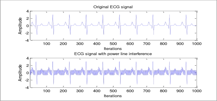 Ecg-Power-Line-Noise.png