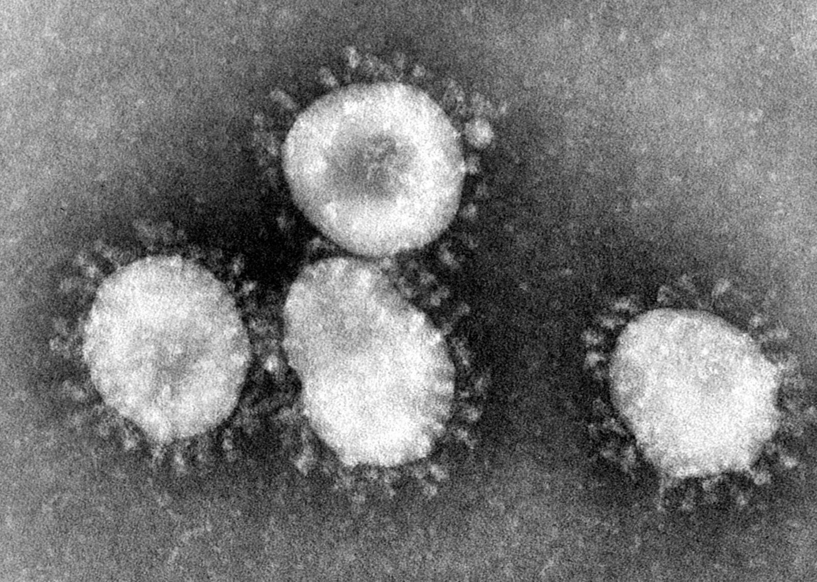 pedia%2Fcommons%2F7%2F78%2FCoronaviruses_004_lores.jpg